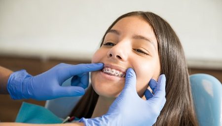 Ortodontik Tedaviler İçin ‘Ergenlik’ En İdeal Dönem